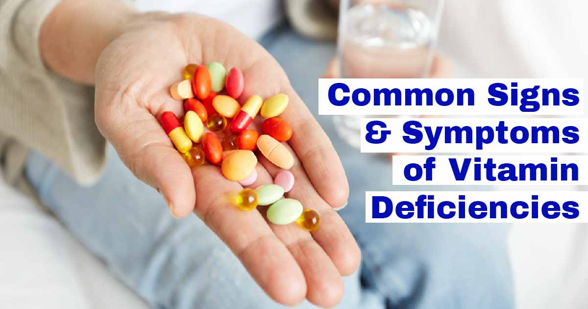 Common Signs And Symptoms Of Vitamin Deficiencies