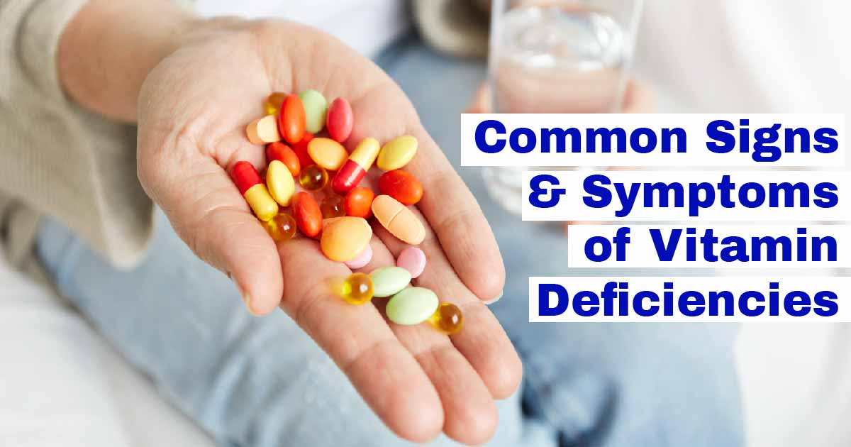 Common Signs and Symptoms of Vitamin Deficiencies