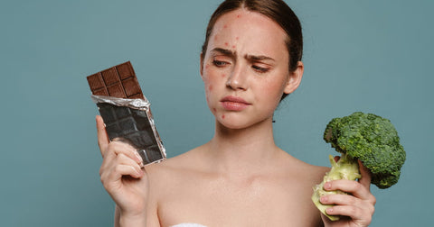 Foods That Cause Acne Dietary Culprits Behind Breakouts