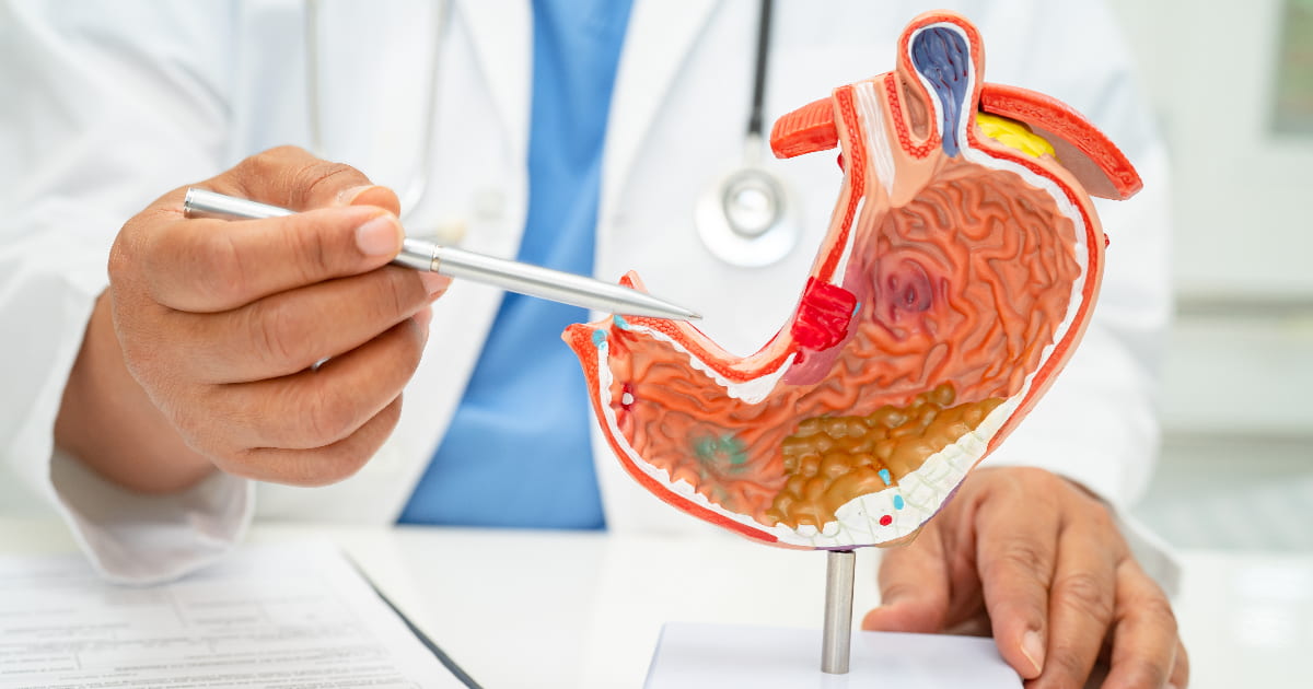 Gastritis and the Gastric Antrum: Understanding the Connection