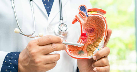 The Link Between Food Sensitivity and Digestive Issues: What You Need to Know