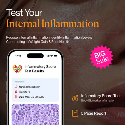 Phone displaying inflammatory score test results with promotional text and sale badge.
